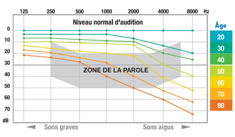 Représentation graphique de la perte auditive